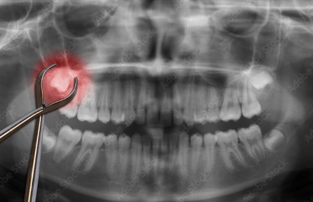 大学病院を紹介されるような難抜歯・腫瘍・嚢胞などの症例・疾患もご相談下さい