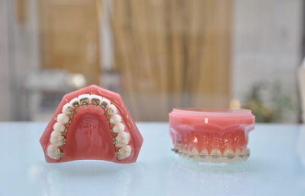 日本矯正歯科学会の専門医が要望に合った最適な矯正治療をご提案します